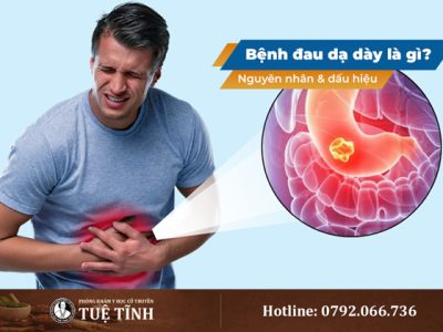 bệnh-đau-dạ dày