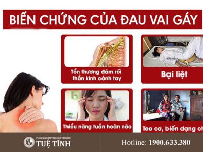 bien-chung-dau-vai-gay