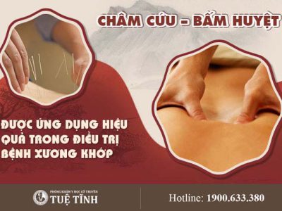 cham-cuu-bam-huyet