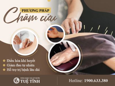 cham-cuu-dieu-hoa-khi-huyet-giam-dau-tu-nhien-ho-tro-tri-benh-lau-dai