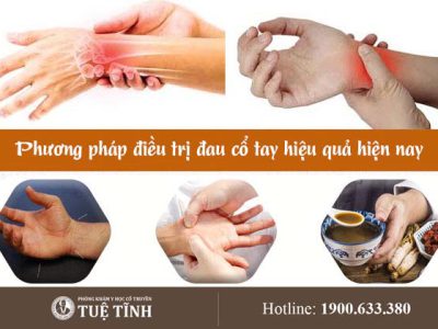 dieu-tri-dau-co-tay-yhct