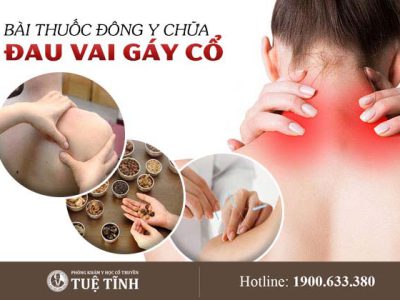 dieu-tri-dau-co-vai-gay-yhct