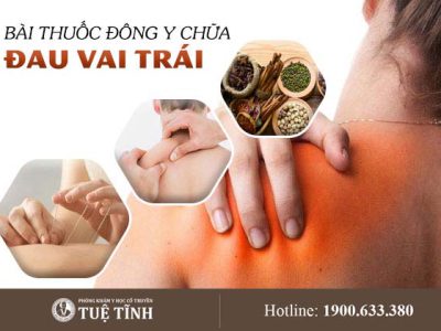 dieu-tri-dau-vai-trai-yhct