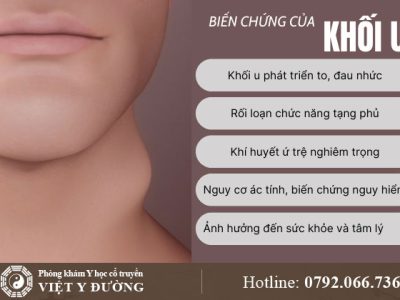 khoi-u-bien-chung