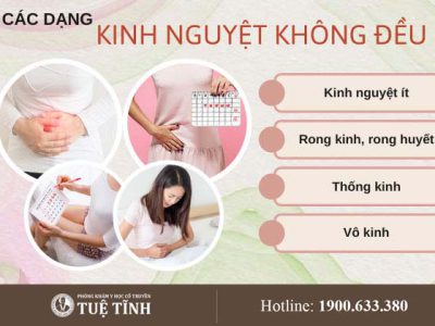 kinh-nguyet-khong-deu-0