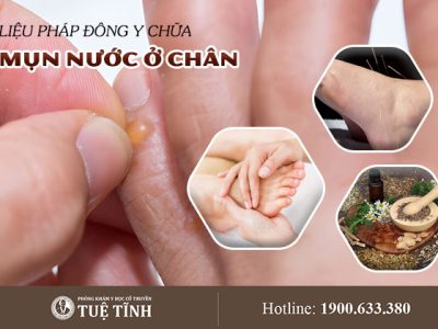 mun-nuoc-o-chan-dieu-tri