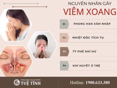 nguyen-nhan-viem-xoang