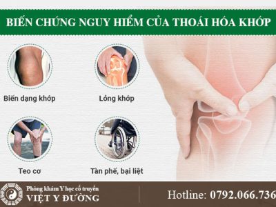 thoai-hoa-khop-bien-chung