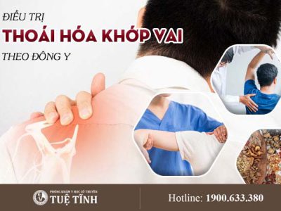 thoai-hoa-khop-vai-01