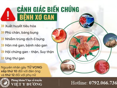 xo-gan-bien-chung